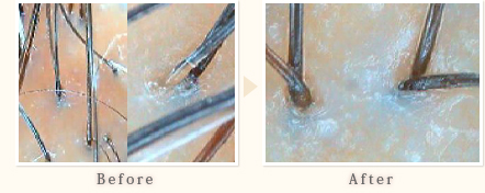 施術事例　50代男性