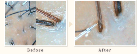 施術事例　40代女性