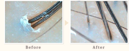 施術事例　20代女性