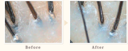 施術事例　30代女性