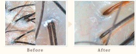 施術事例　40代女性