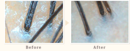 施術事例　40代男性