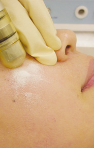 角質ケアコース